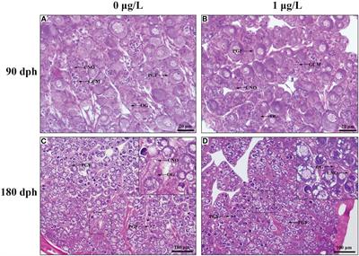 The adverse effects of 17β-estradiol immersion during gonadal differentiation on ovarian development of female Takifugu rubripes